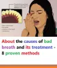 About the causes of bad breath and its treatment - 8 proven methods
