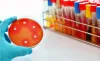 Necessity of Microbiological Testing Laboratory To Keep Save Yourself