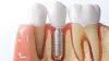  Dentist Near Me  — What is the difference between a periodontist and...