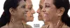 Basal Implants India, Basal Implant Technology in Mumbai