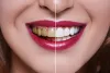 Studio Smiles NYC — How Does Affordable Dentistry Help You?