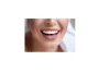 4 Types Of Dental Veneers: