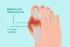 12 superfood that helps you to reduce uric acid naturally :: Herbal and Home Remedies