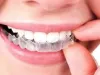 Dental Crowns: Types, Procedure, And Their Necessity