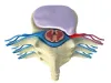 How Chiropractic Can Treat a Herniated Disc and Pain