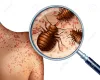 Uncovering Bed Bug Eggs: A Comprehensive Guide To Identification