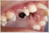 High Quality Dental and Cosmetic Care Available in South East London