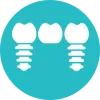 Dental Implants only within 2 days | Trisa Dental Solutions 