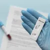                   Applications of Rapid Antigen Tests | Ekonty     