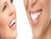 Skilled After Hours Dentist In Encino
