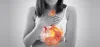 Best Gastroenterologist in Hyderabad india | Acid Peptic Disease