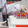 High Sensitivity C-Reactive Protein (CRP) Test or HsCRP Blood Test in Delhi - Metropolis Healthcare