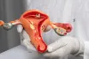 Blocked Fallopian Tubes:  Symptoms,Causes, Treatment
