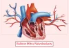  Balloon Mitral Valvuloplasty | EdhaCare 