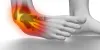 Sprained Ankle: Symptoms