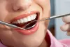 Expectation During Teeth Cleaning Procedure