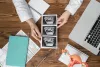 Understanding Follicular Study : A Comprehensive Guide
