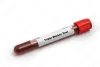 Understanding the Triple Marker Test: What You Need to Know