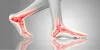 The Basics of Ankle Anatomy and Foot Anatomy