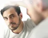 Hair Transplant in Gurgaon | SB Trichology