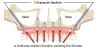 Affordable Zygomatic Implants in India |  Trisa Dental Solutions 