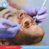 Dentist Emergency in West Simsbury