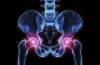 Before and After of Hip Fracture Surgery