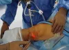 Best Knee Replacement Surgeon in Hyderabad | Dr. Srinivas Kasha