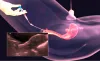  Visit IUI Specialist in Dombivli- Akruti IVF