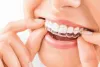 Clínica Dental y Estética Facial en Sanlúcar de Barrameda!