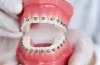 How Does An Orthodontist Help In Getting Straight Teeth?