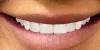 KAA Dentals Offer The Wide Range Of Treatments By 'experts
