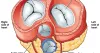 What Is The Cost Of Heart Valve Surgery In India? - teemey