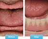Learning Some Important Facts About Dental Implant Procedures - smileagainmumbai’s blog