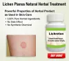 Natural Remedies for Lichen Planus Treat with Natural Essential Oil