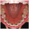 Why Common Dental Checkup is Important?