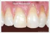 What Should You Do During Dental Emergency?