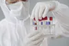 India surpassed Milestone of 10 crores COVID-19 sample testing – Thanks To Indian Diagnostic Labs
