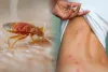 Bed Bugs Pest Control Services Singapore