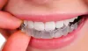 TMJ disorder specialists near me