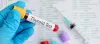 The Importance of Thyroid Blood Tests: ext_6201632 — LiveJournal