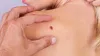 What is Melanoma