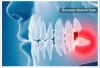An Emergency Dentist is Readily Available for Your Solution