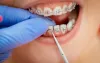 Orthodontic Treatment