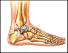 Treatment Of Sinus Tarsi Syndrome | Pain Free Physiotherapy Clinic - JustPaste.it