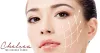 Get Effective and Reasonable Skin Treatments at Clinics in Singapore - The Chelsea Clinic