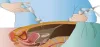 Embarking on Laparoscopic Excellence Training Pathways - Top DM Darama