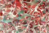 Bone Metabolism ELISA Kit Customization Service - Creative Diagnostics