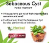 Natural Remedies for Sebaceous Cyst