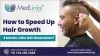 How to Speed up Hair Growth 3 Months after Hair Restoration?